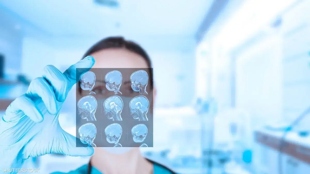 الصورة الرئيسية للمقال