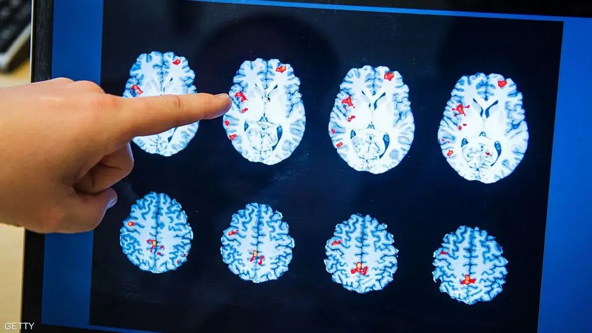 الصورة الرئيسية للمقال