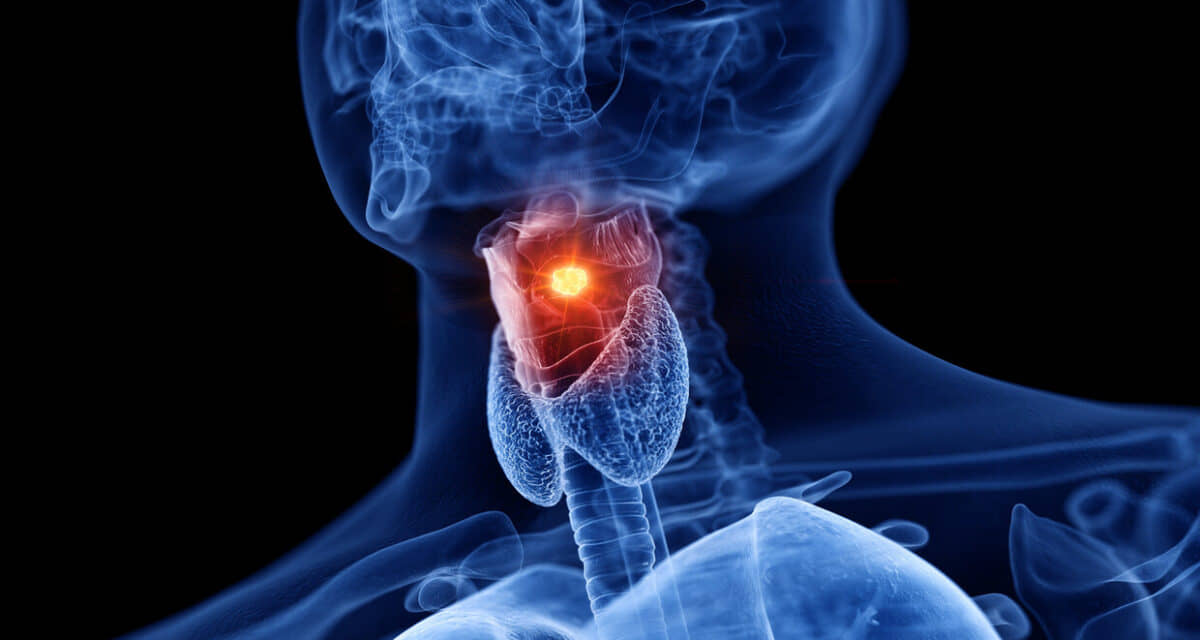 الصورة الرئيسية للمقال