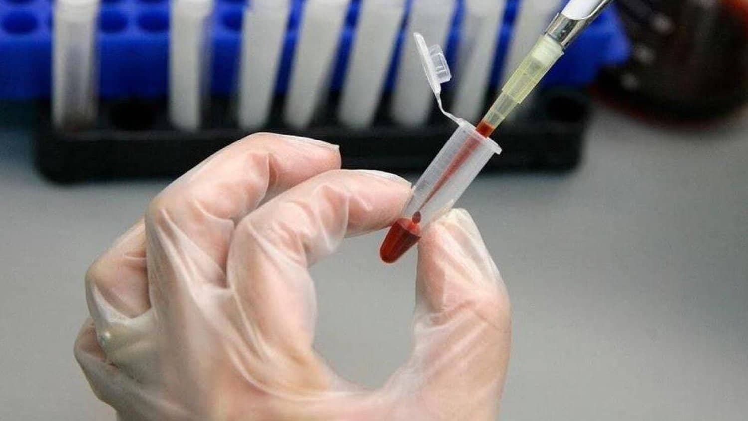 الصورة الرئيسية للمقال