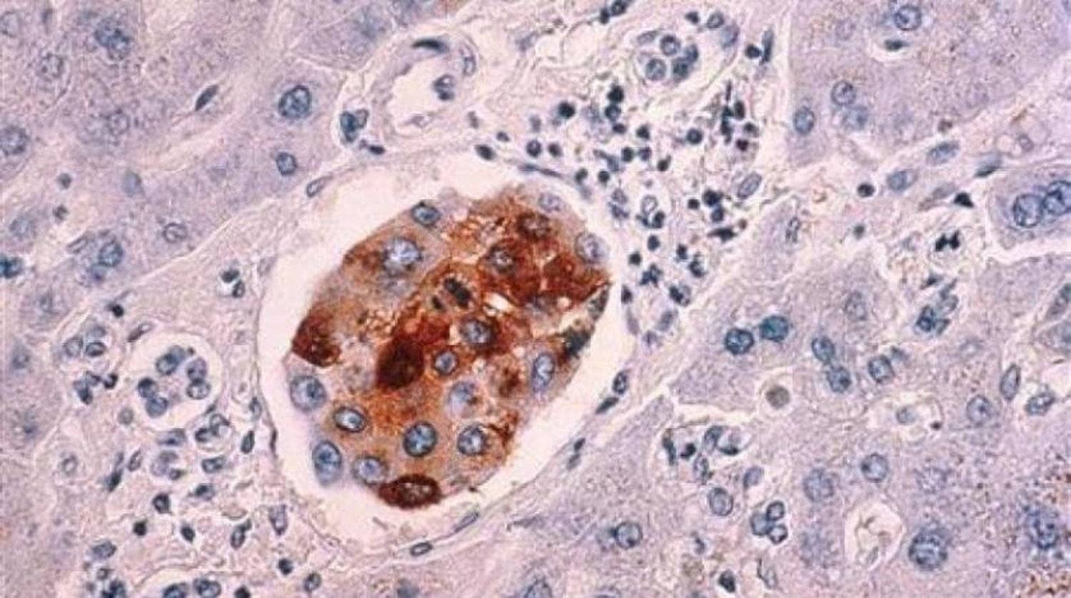 الصورة الرئيسية للمقال