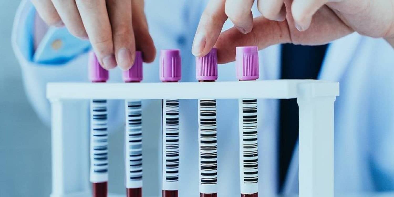 الصورة الرئيسية للمقال