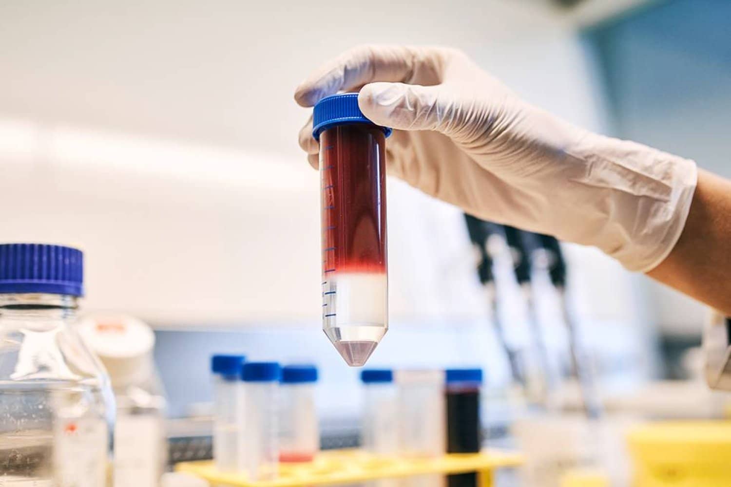 الصورة الرئيسية للمقال