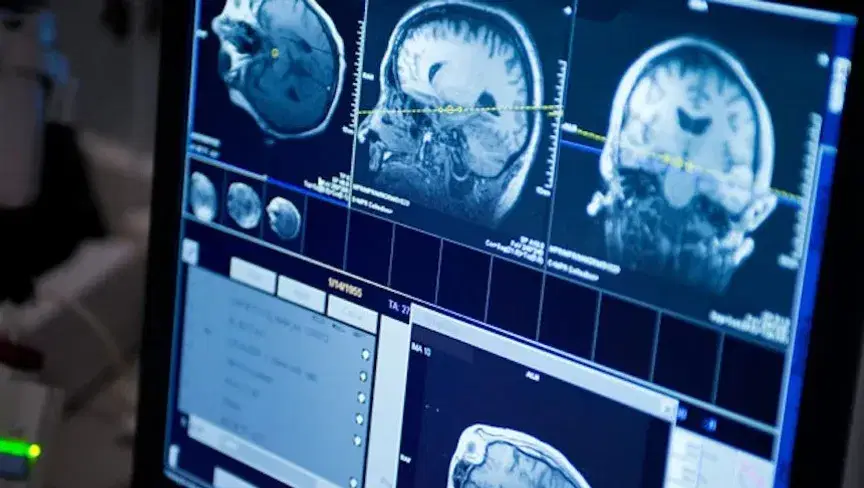 الصورة الرئيسية للمقال