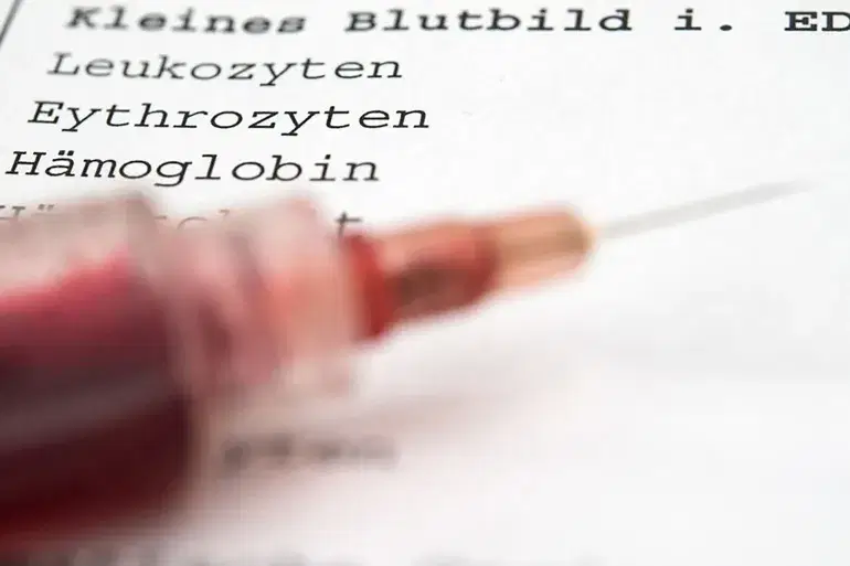 الصورة الرئيسية للمقال