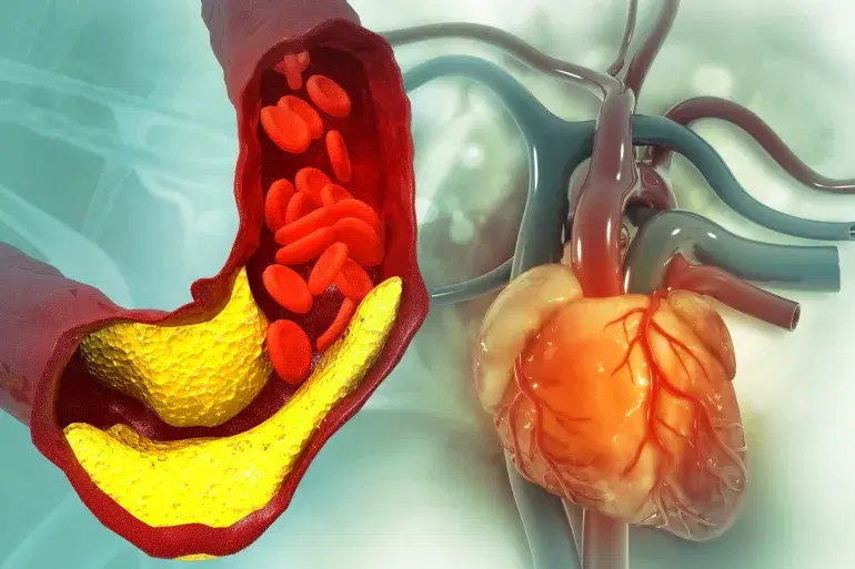 الصورة الرئيسية للمقال